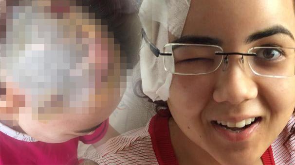 26 vida ve 6 tane plakla sabitlediler!  Resmen mucize...