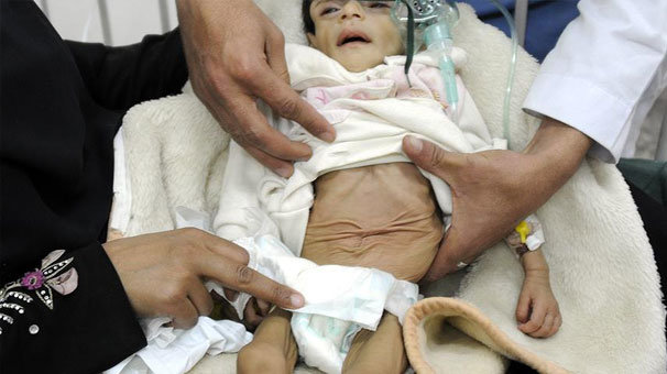 BM'den Yemen'de 'kıtlık riski' uyarısı