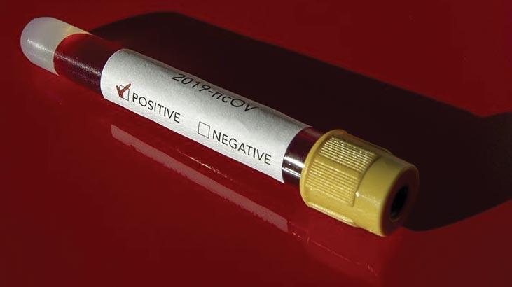 Brezilya'da son 24 saatte covid-19 nedeniyle 188 kişi öldü