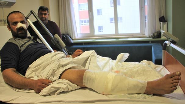 Burnunu ve bacağını parçaladılar, annesi son anda kurtardı! 'Beni götürüp getirdiler...'