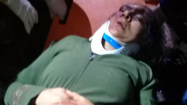 Çukura düşen kadını itfaiye kurtardı