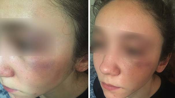 Hocası Milli sporcuyu darp etti! 'Mahkemede görüşeceğiz'