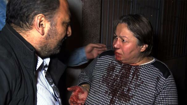 İki aile arasında baltalı ve bıçaklı kavga: 5 yaralı, 3 gözaltı