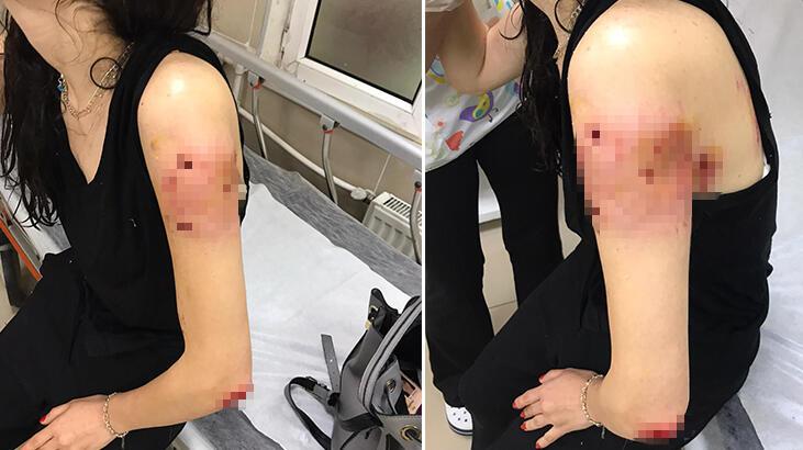 İstanbul'da işe giden genç kıza sokak köpekleri saldırdı