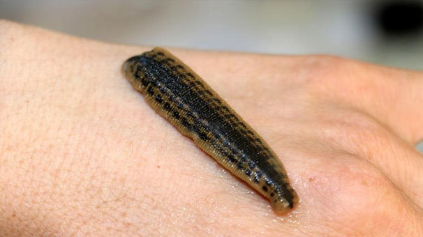 K.Kore’ye ‘tıbbi’ sülük