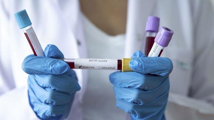 Kıbrıs'ta corona virüs vaka sayıları artmaya devam ediyor