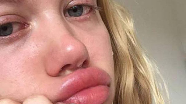 Serel Yereli ağlarken çekti