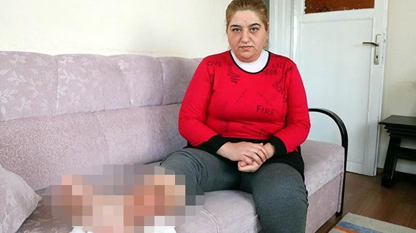 Sivilceyi önemsemedi, hayatı karardı