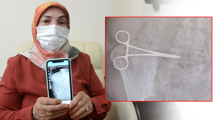 Son dakika... Aydın'da akılalmaz olay! Karnında unutulan makasla 2 ay yaşadı