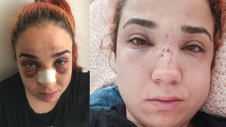 Son dakika: Patron vahşeti bu hale getirdi!