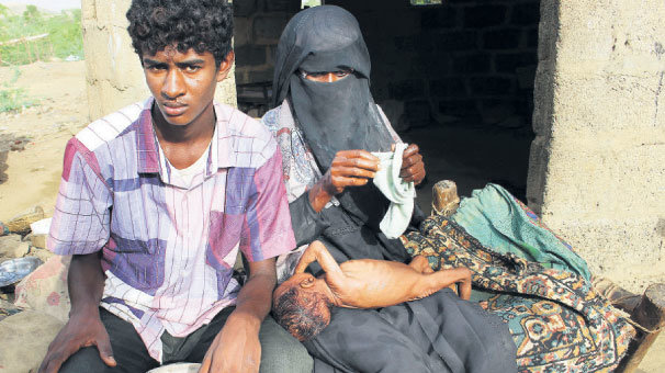 Yemen’de ‘iç ürperten’ gerçek!